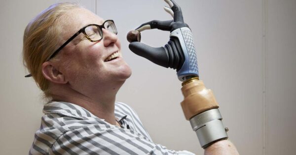 Cyberpunk în lumea reală: o femeie testează o mână artificială conectată direct la sistemul nervos