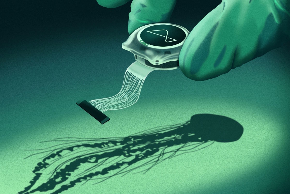 Neuralink implant